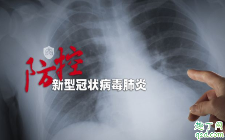 新冠肺炎潜伏期最长24天真的假的 新型肺炎有超级传播者吗