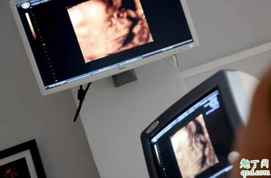 做四维彩超空腹好还是吃饱好 四维彩超吃东西就能通过吗