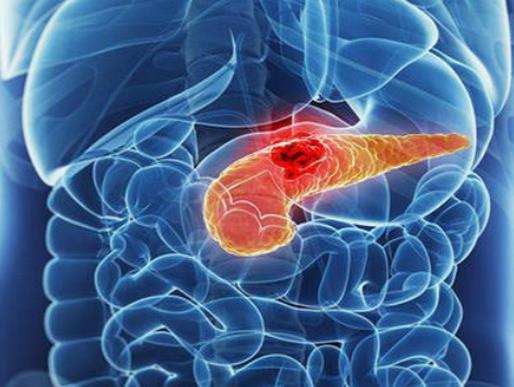 世界十大痛苦癌症排行，胃癌发病率高，肺癌死亡率最快