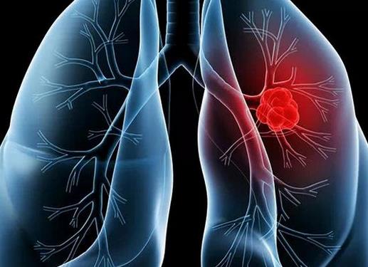 世界十大痛苦癌症排行，胃癌发病率高，肺癌死亡率最快