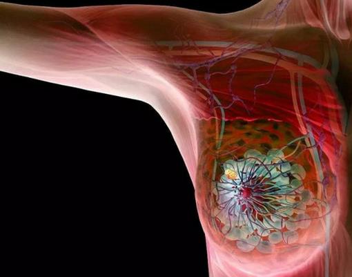 世界十大痛苦癌症排行，胃癌发病率高，肺癌死亡率最快