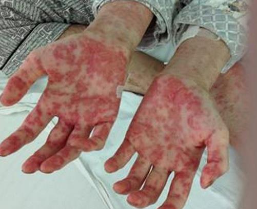 世界十大痛苦癌症排行，胃癌发病率高，肺癌死亡率最快