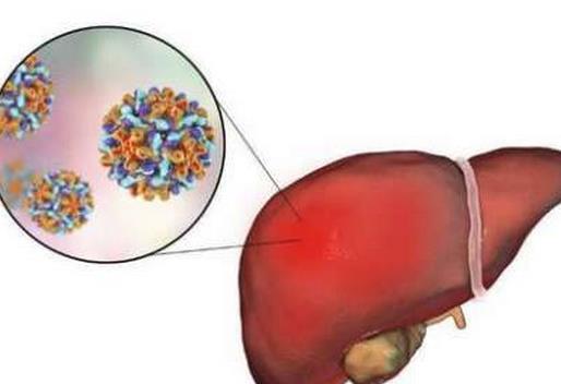 世界十大痛苦癌症排行，胃癌发病率高，肺癌死亡率最快