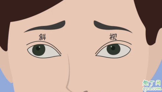 为什么小孩看东西头会斜 儿童斜视是什么症状