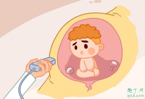 胎停有没有希望活过来 孕早期胎停育有哪些征兆