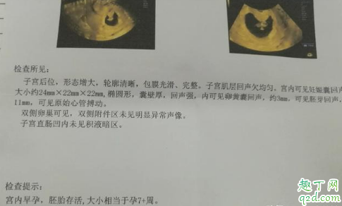 怀孕七周没有胎心什么原因 怀孕7周肚子有点隐痛怎么回事