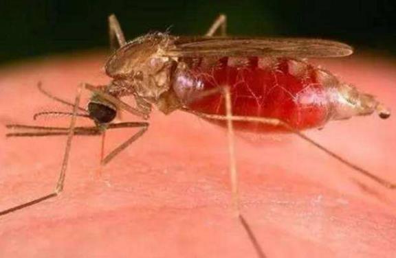 起床后上眼皮肿是怎么回事？有效缓解上眼皮肿的方法