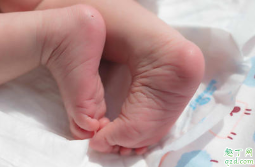 新生儿足底血查什么 足底血什么时候采最好