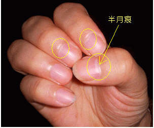 指甲上的半月痕你懂多少？指甲半月痕与健康吉凶关系