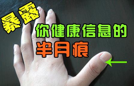 指甲上的半月痕你懂多少？指甲半月痕与健康吉凶关系