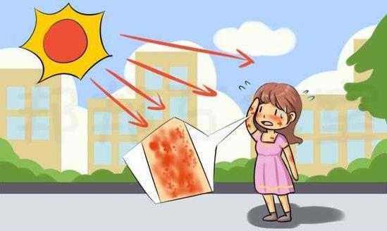 紫外线过敏的症状 紫外线过敏怎么办用什么药