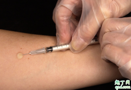 孩子打了百白破胳膊红肿怎么办 小孩百白破针要连打三针吗