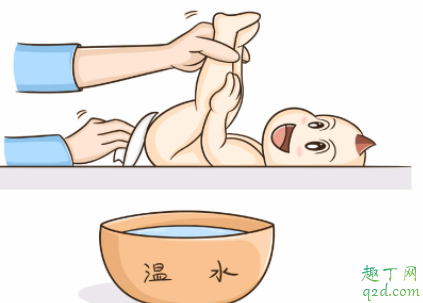 宝宝特别容易得尿布疹怎么办 宝宝为什么会有尿布疹