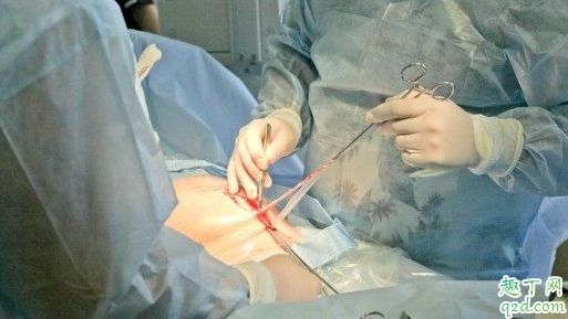 剖腹产后不过气怎么回事 剖腹产后如何快速过气
