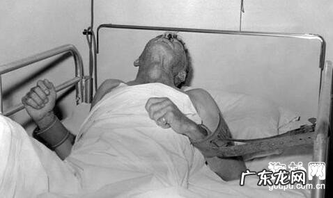 【狂犬病毒早期症状】狂犬病症状及防止方式