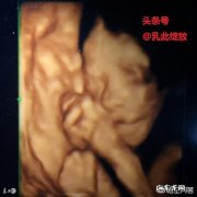 孕妇照四维需要在多少周以前呢？