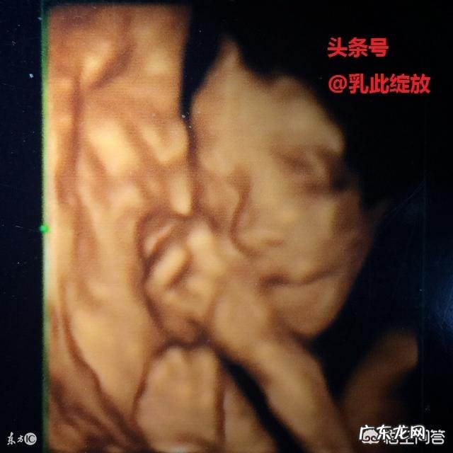 孕妇照四维需要在多少周以前呢?