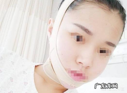 什么脸型适合做下颌角磨骨