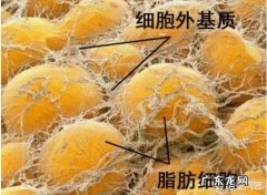 如果用脂肪丰胸存活率有多少有哪些注意事项