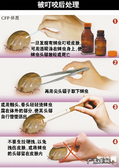 用什么方法能够 合理除去蜱虫?