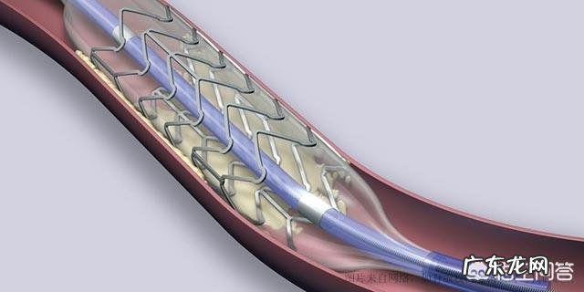 因为心脏病上了支架但还是难受，应该怎么办