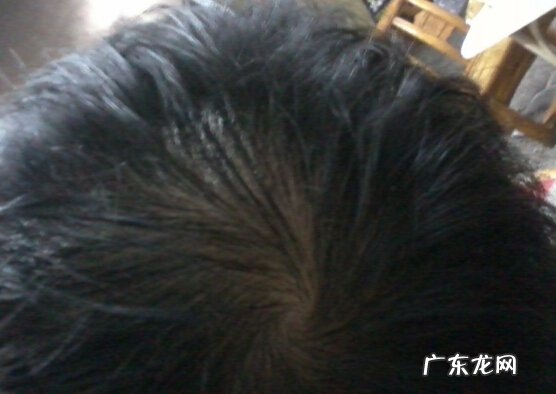 小狗白屑该怎么办