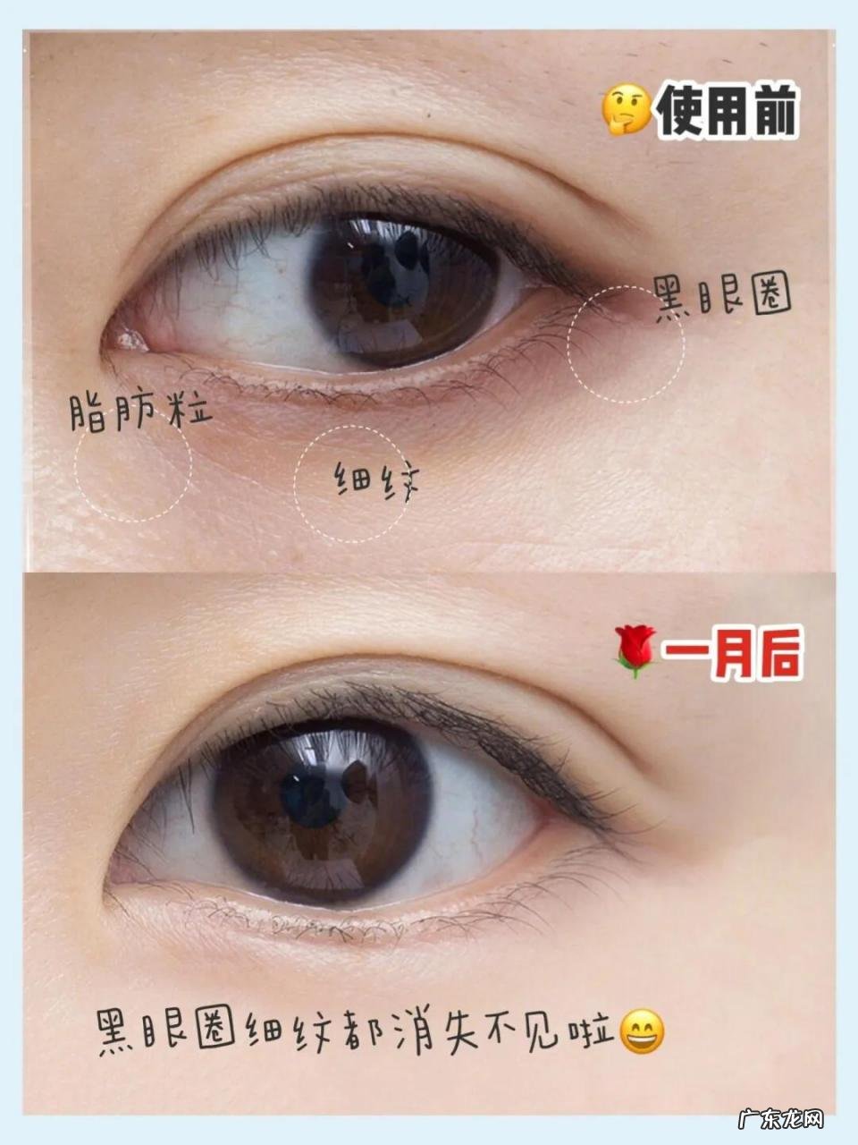 美眼仪使用教程 美的磁力美眼仪有效果吗