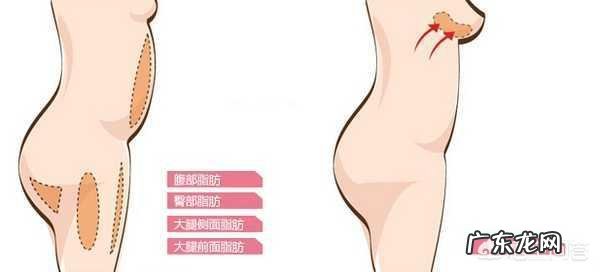 自体脂肪填充胸部能维持多久