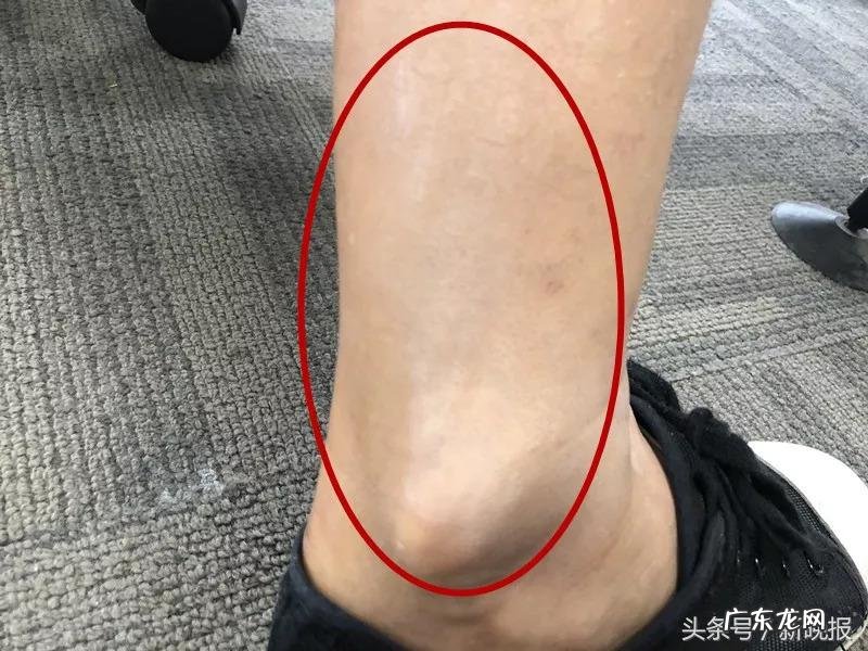 抖音美白神器是真的吗?靠谱么?