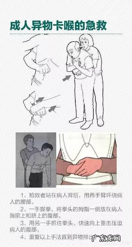 鱼刺卡喉怎么办喝醋、吃馒头有用吗该怎样处理