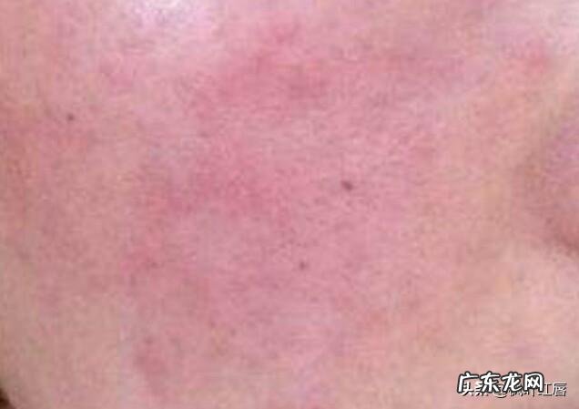 清理皮肤用洗面奶和卸妆水，还需要用别的吗