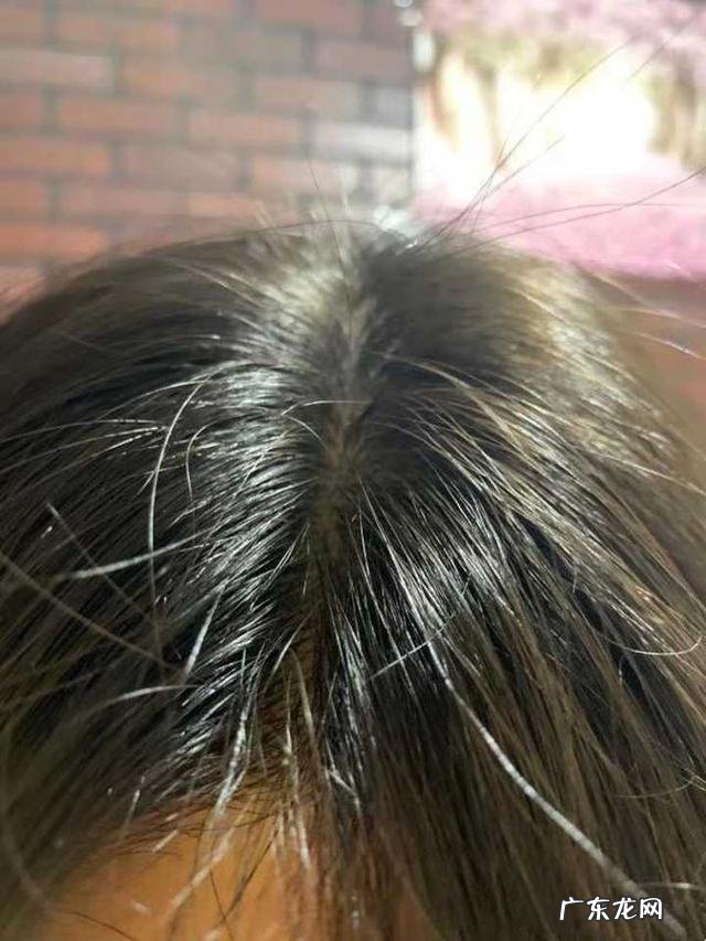 你认为护肤品可以祛斑祛痘使人变漂亮吗