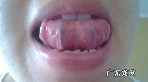 花椒治失眠最快 治疗失眠的十大偏方