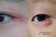 形容眼肿的搞笑句子 【抖音文案】关于眼肿的句子