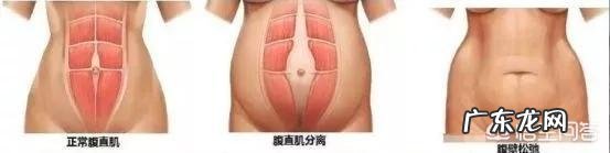 二胎妈妈,产后150减到106的愿望如何实现