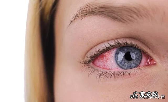 夏季肝火旺,哪些食物又便宜又降火