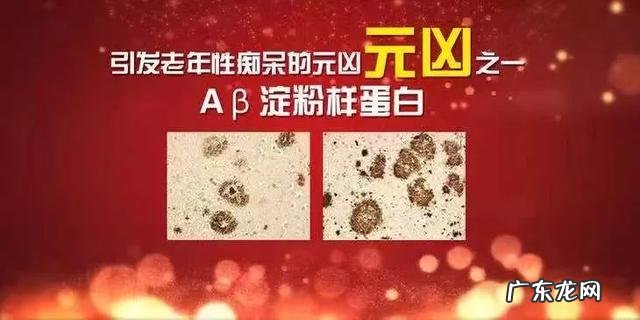 我国有超过2亿人存在睡眠问题或睡眠障碍-睡不好觉成了当代人的通病之一