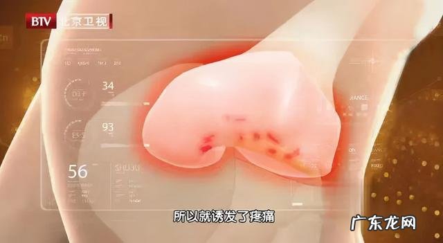 我国有超过2亿人存在睡眠问题或睡眠障碍-睡不好觉成了当代人的通病之一