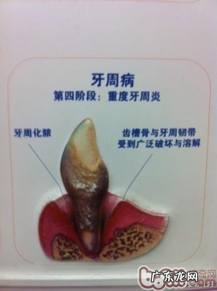 介绍普遍的狗类口腔科难题