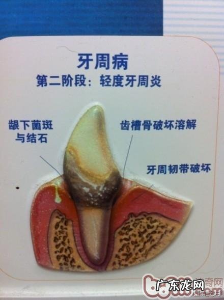 介绍普遍的狗类口腔科难题