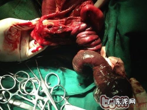 一例德牧犬比较严重肠套叠病例分析