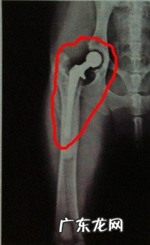 探讨犬的髋关生长发育出现异常的医治