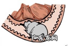 一例犬结肠割开取下脏东西的手术治疗