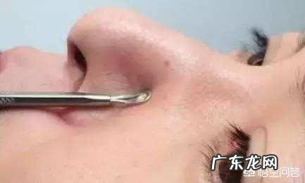 怎么消除脸上痘痘和挤完痘痘留下的斑