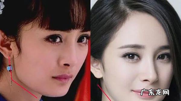 揭秘杨幂整容真相 杨幂整容了吗