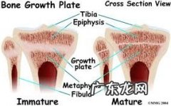 一例犬骨垢线端骨裂病案