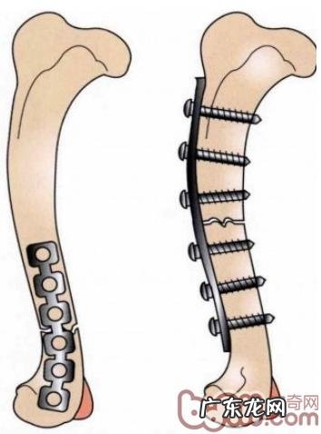 一例犬股骨头远侧骨裂经典案例