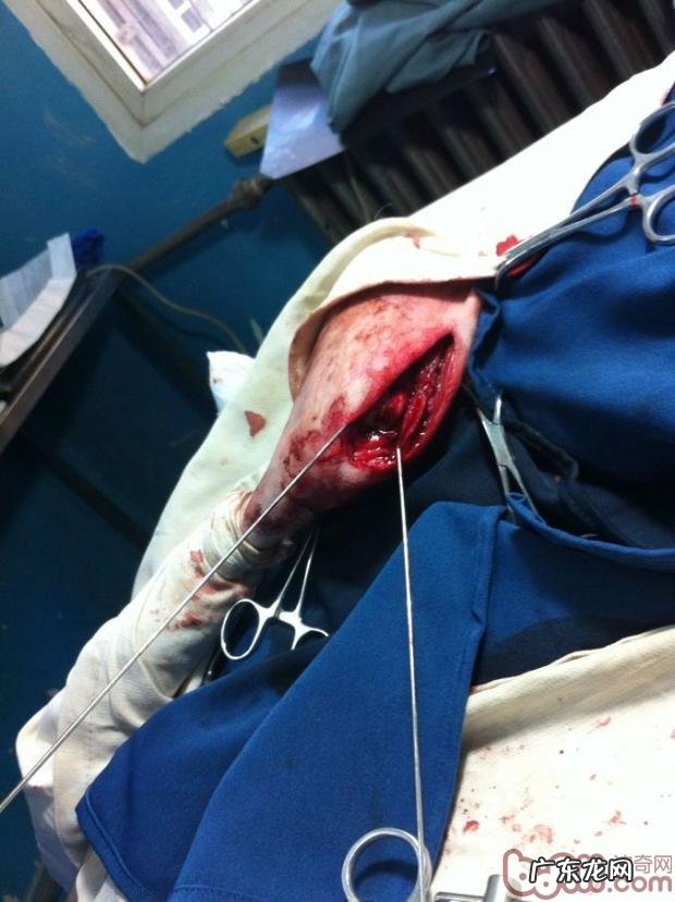 一例犬股骨头远侧骨裂经典案例