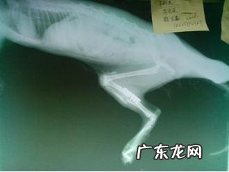 一例有关骨裂后医治耽误的实例