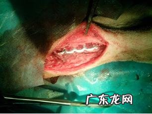 一例有关骨裂后医治耽误的实例